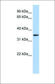 Anti-HADH antibody produced in rabbit affinity isolated antibody