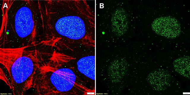 Anti-TRF2 Antibody, clone 1N14 ZooMAb&#174; Rabbit Monoclonal recombinant, expressed in HEK 293 cells