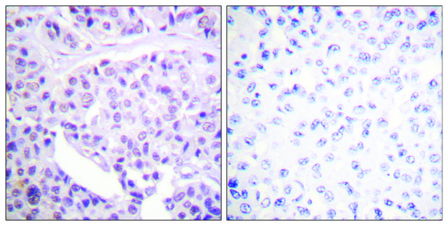 Anti-p53, antibody produced in rabbit affinity isolated antibody