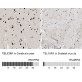 抗-TBL1XR1 兔抗 Prestige Antibodies® Powered by Atlas Antibodies, affinity isolated antibody, buffered aqueous glycerol solution