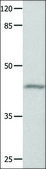 Anti-GNA11 antibody produced in rabbit affinity isolated antibody
