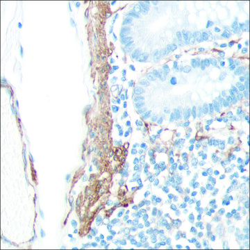 抗- SMA 抗体，兔单克隆 clone SP171, recombinant, expressed in proprietary host, affinity isolated antibody