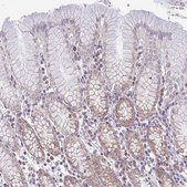 Anti-PYCR2 antibody produced in rabbit Prestige Antibodies® Powered by Atlas Antibodies, affinity isolated antibody, buffered aqueous glycerol solution