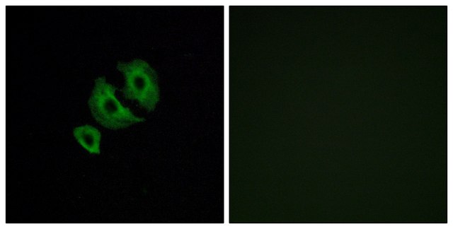 Anti-OR10J6 antibody produced in rabbit affinity isolated antibody