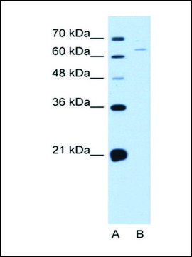 Anti-NOX1 affinity isolated antibody