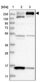Anti-ARAP2 antibody produced in rabbit Prestige Antibodies® Powered by Atlas Antibodies, affinity isolated antibody, buffered aqueous glycerol solution