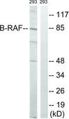 Anti-B-RAF antibody produced in rabbit affinity isolated antibody