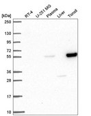 Anti-PPARA antibody produced in rabbit Prestige Antibodies® Powered by Atlas Antibodies, affinity isolated antibody