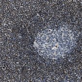 Anti-SP100 antibody produced in rabbit Prestige Antibodies® Powered by Atlas Antibodies, affinity isolated antibody, buffered aqueous glycerol solution