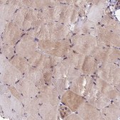 Anti-MIOS antibody produced in rabbit Prestige Antibodies® Powered by Atlas Antibodies, affinity isolated antibody, buffered aqueous glycerol solution