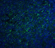 Anti-CCR5 antibody produced in rabbit affinity isolated antibody