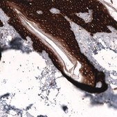 Monoclonal Anti-Krt14 Antibody Produced In Mouse Prestige Antibodies&#174; Powered by Atlas Antibodies, clone CL14568, affinity isolated antibody, buffered aqueous glycerol solution