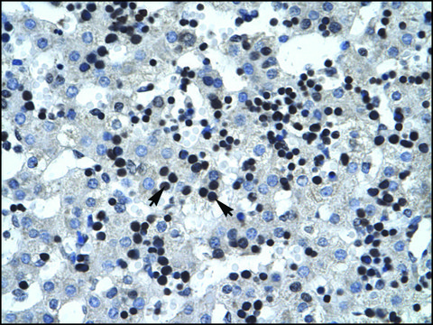 Anti-SMARCB1 antibody produced in rabbit affinity isolated antibody