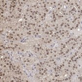 Anti-TPI1 antibody produced in rabbit Prestige Antibodies® Powered by Atlas Antibodies, affinity isolated antibody