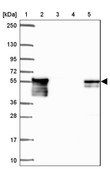Anti-DTNB antibody produced in rabbit Prestige Antibodies® Powered by Atlas Antibodies, affinity isolated antibody, buffered aqueous glycerol solution