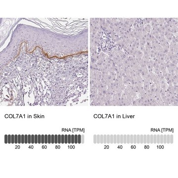 Anti-COL7A1 antibody produced in rabbit Prestige Antibodies&#174; Powered by Atlas Antibodies, affinity isolated antibody, buffered aqueous glycerol solution