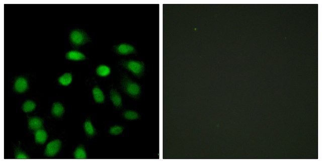 Anti-SCAND1 antibody produced in rabbit affinity isolated antibody