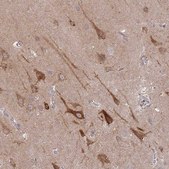 Anti-SPHKAP antibody produced in rabbit Prestige Antibodies® Powered by Atlas Antibodies, affinity isolated antibody, buffered aqueous glycerol solution