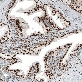 Monoclonal Anti-AR antibody produced in mouse Prestige Antibodies® Powered by Atlas Antibodies, clone CL9255, purified immunoglobulin, buffered aqueous glycerol solution