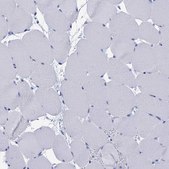 Anti-CALML5 antibody produced in rabbit Prestige Antibodies® Powered by Atlas Antibodies, affinity isolated antibody, buffered aqueous glycerol solution
