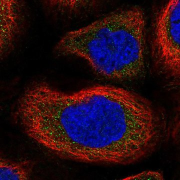 Anti-Slk Antibody Produced In Rabbit Prestige Antibodies&#174; Powered by Atlas Antibodies, affinity isolated antibody, buffered aqueous glycerol solution