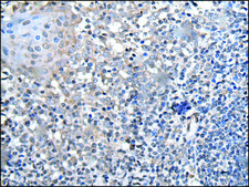 Anti-HOXD1 affinity isolated antibody
