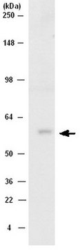 Anti-Src Antibody, CT, clone NL19 | 04-772 clone NL19, Upstate&#174;, from rabbit