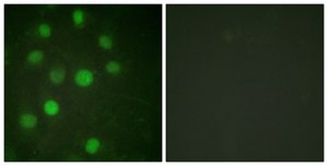 Anti-Histone H1 antibody produced in rabbit affinity isolated antibody