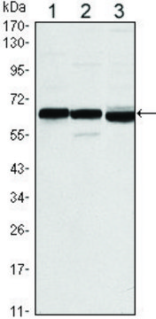 Monoclonal Anti-ESR1 antibody produced in mouse clone 6B6, ascites fluid