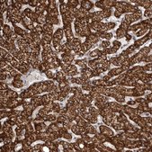 Anti-SNX16 antibody produced in rabbit Prestige Antibodies® Powered by Atlas Antibodies, affinity isolated antibody, buffered aqueous glycerol solution, ab2