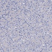 Anti-KLHL17 antibody produced in rabbit Prestige Antibodies® Powered by Atlas Antibodies, affinity isolated antibody, buffered aqueous glycerol solution