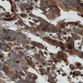 Monoclonal Anti-STAT3 antibody produced in mouse Prestige Antibodies® Powered by Atlas Antibodies, clone CL0490, purified immunoglobulin, buffered aqueous glycerol solution