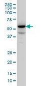 Monoclonal Anti-PPM1F antibody produced in mouse clone 2A9, purified immunoglobulin, buffered aqueous solution