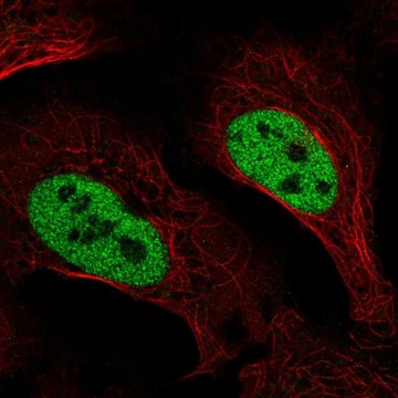 Anti-SLC4A3 antibody produced in rabbit Prestige Antibodies&#174; Powered by Atlas Antibodies, affinity isolated antibody