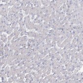 Anti-FAM216A antibody produced in rabbit Prestige Antibodies® Powered by Atlas Antibodies, affinity isolated antibody, buffered aqueous glycerol solution