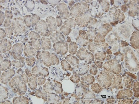 Monoclonal Anti-TP53 antibody produced in mouse clone 2C3, purified immunoglobulin, buffered aqueous solution