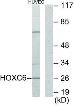 Anti-HOXC6 antibody produced in rabbit affinity isolated antibody