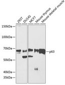 Anti-p63 Antibody, clone 3M9X7, Rabbit Monoclonal