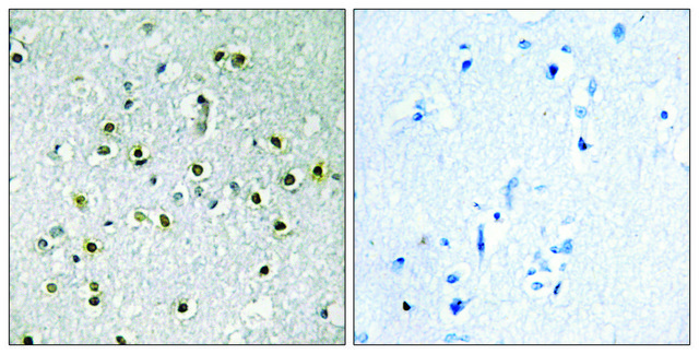 Anti-TFE3 antibody produced in rabbit affinity isolated antibody