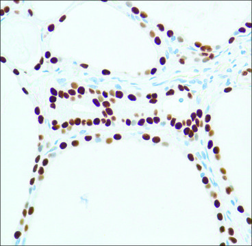 Anti-Thyroid Transcription Factor-1 antibody, Rabbit monoclonal recombinant, expressed in proprietary host, clone SP141, affinity isolated antibody