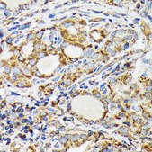 Anti-NDUFS4 antibody produced in rabbit