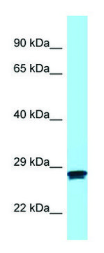 Anti-MC2R (N-terminal) antibody produced in rabbit affinity isolated antibody