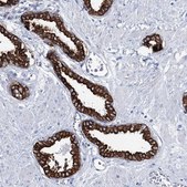 Anti-ADGRL1 antibody produced in rabbit Prestige Antibodies® Powered by Atlas Antibodies, affinity isolated antibody, buffered aqueous glycerol solution