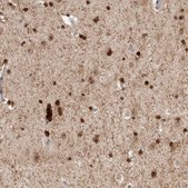 Anti-ZNF521 antibody produced in rabbit Prestige Antibodies® Powered by Atlas Antibodies, affinity isolated antibody, buffered aqueous glycerol solution, Ab1