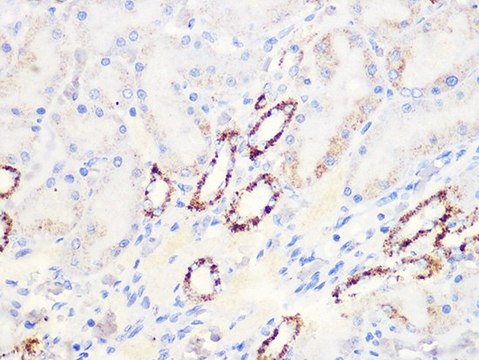 Anti-Aconitase 2 (ACO2) antibody produced in rabbit