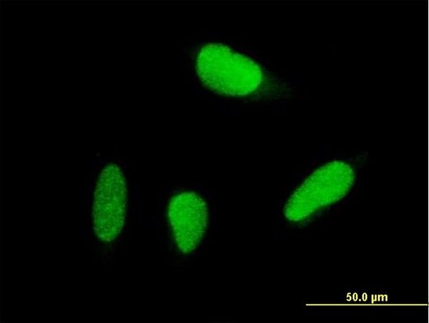 Anti-USP18 antibody produced in mouse purified immunoglobulin, buffered aqueous solution