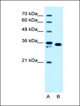 Anti-AKR1B1 antibody produced in rabbit IgG fraction of antiserum