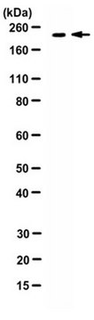 Anti-Ecm29 Antibody (Ab Ecm29-2) serum, from rabbit