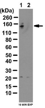 抗-磷酸化-TBC1D1抗体（Ser237） from rabbit, purified by affinity chromatography