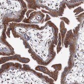 Anti-RCN1 antibody produced in rabbit Prestige Antibodies® Powered by Atlas Antibodies, affinity isolated antibody, buffered aqueous glycerol solution